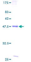 Human PRKAA1 / AMPK Alpha 1 Protein (Recombinant GST)