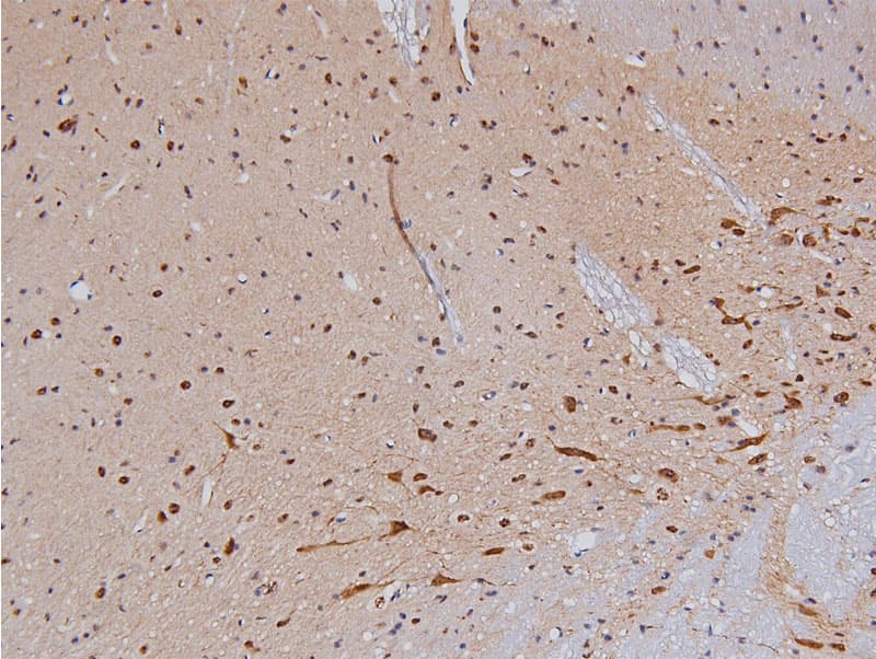 TH / Tyrosine Hydroxylase Antibody (phospho-Ser40)