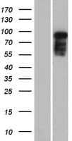 MAP7D2 Protein (Over-Expression Lysate Myc-DDK (Flag))