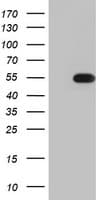 TIPIN Antibody (clone OTI2E6)
