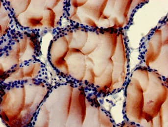 PLS3 / T Plastin Antibody