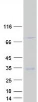 Human GPM6A / Glycoprotein M6A (Recombinant Myc-DDK (Flag))