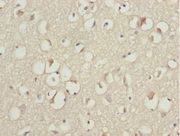 Polyclonal Rabbit anti-Human KBTBD7 Antibody (IHC)