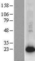 AGR2 Protein (Over-Expression Lysate Myc-DDK (Flag))