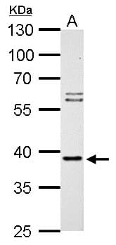 Polyclonal Rabbit anti-Human SAE1 Antibody (aa3-247, IHC, WB)