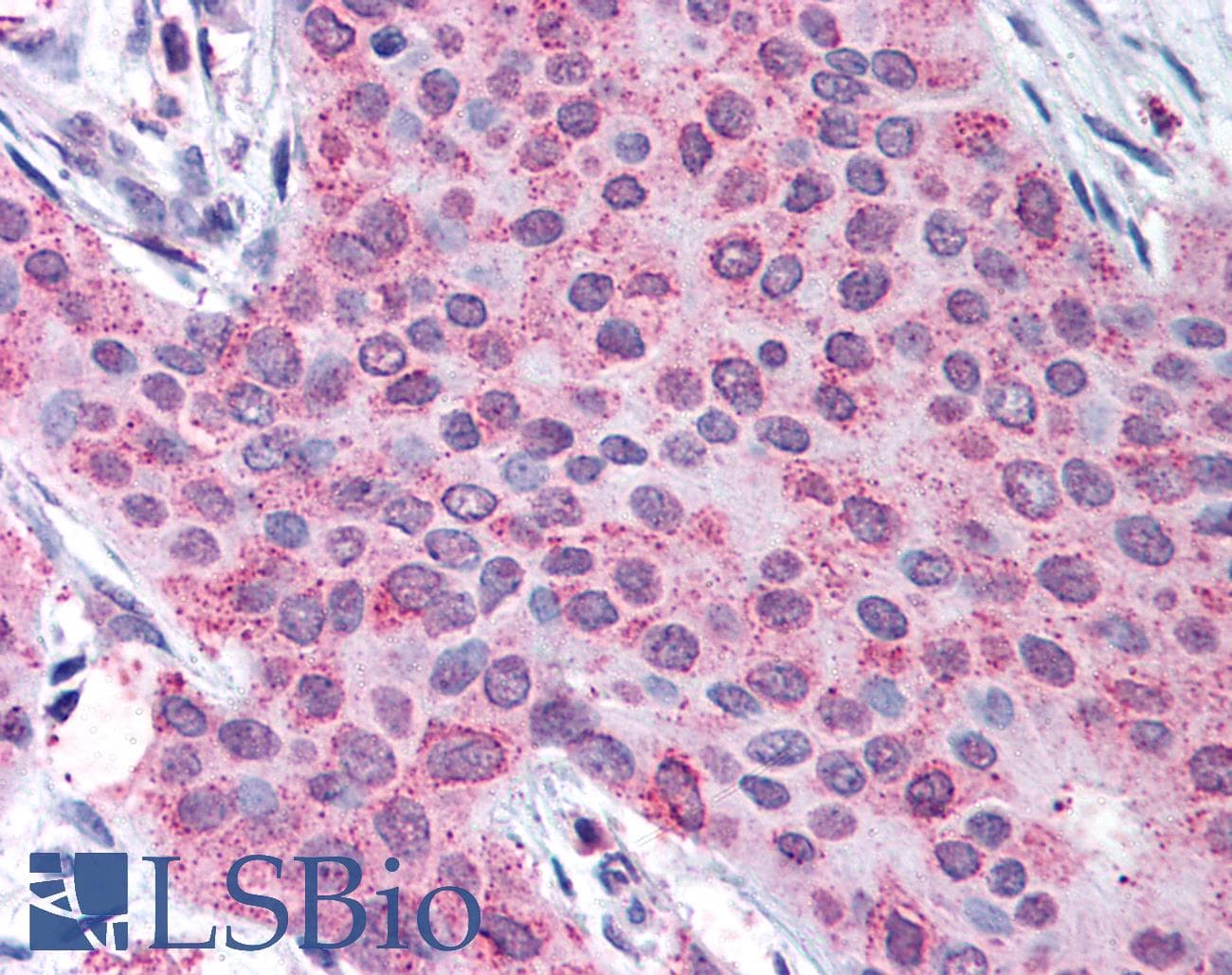 IHC-plus™ MMP13 Antibody (C-Terminus)