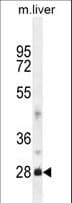 IHC-plus™ Polyclonal Rabbit anti-Human DNAJB8 Antibody (aa41-69, IHC, WB)