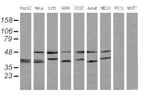 MAP2K3 / MEK3 / MKK3 Antibody (clone OTI3D10)