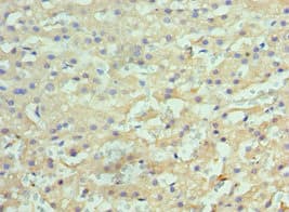 Polyclonal Rabbit anti-Human HYOU1 / ORP150 Antibody (aa1-140, IHC)