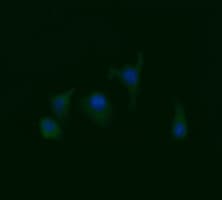 RAB21 Antibody (clone OTI4A6)