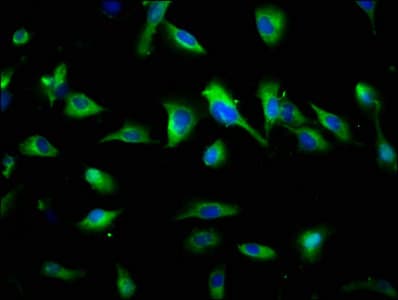Polyclonal Rabbit anti-Human SYNPR / Synaptoporin Antibody (WB)