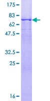 Human ACTR1B Protein (Recombinant GST)