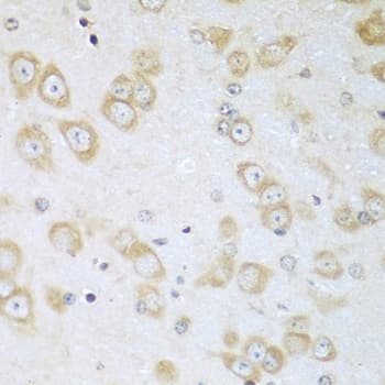 Polyclonal Rabbit anti-Human ACOX1 / ACOX Antibody (IHC, WB)