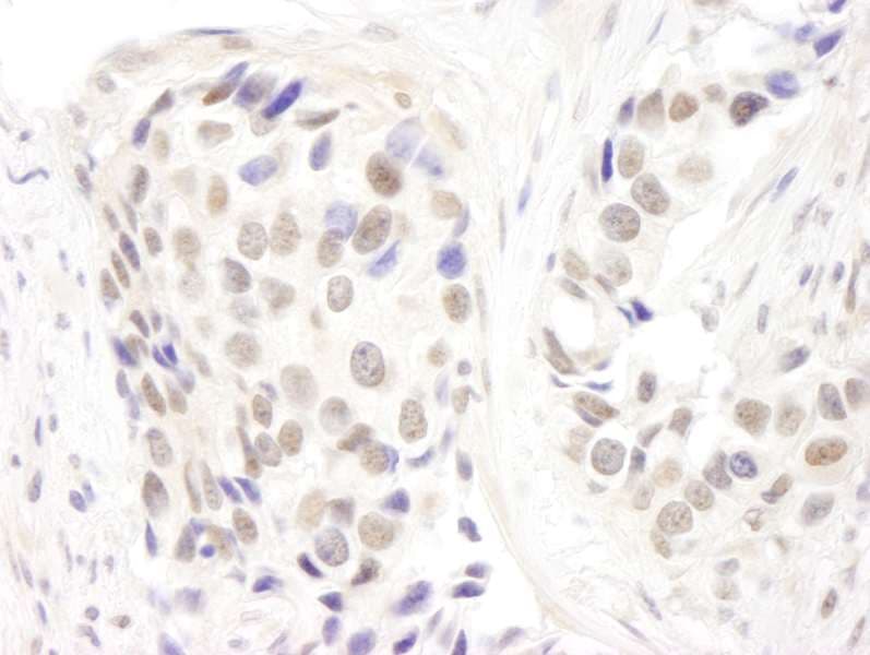 Polyclonal Rabbit anti-Human GATAD2A Antibody (aa573-633, IHC)