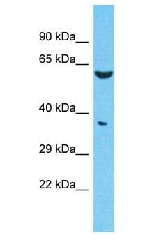 FAM47E Antibody (aa301-350)