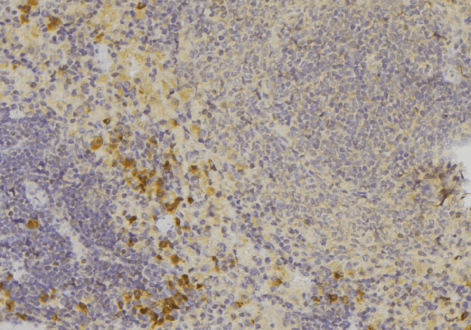 CCBE1 Antibody