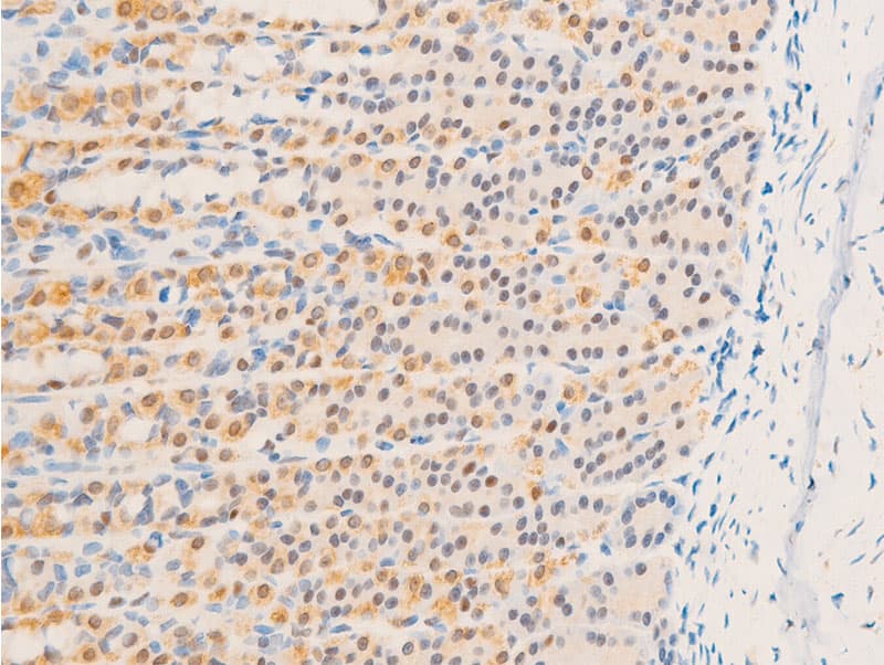 NR3C1/Glucocorticoid Receptor Antibody (phospho-Ser226)