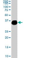 IHC-plus™ Monoclonal Mouse anti-Human ELAVL4 / HuD Antibody (clone 6B9, IHC, WB)