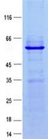 Human MDM2 Protein (Recombinant His, N-Terminal)