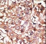 Polyclonal Rabbit anti-Human STUB1 / CHIP Antibody (aa203-231, IHC, WB)