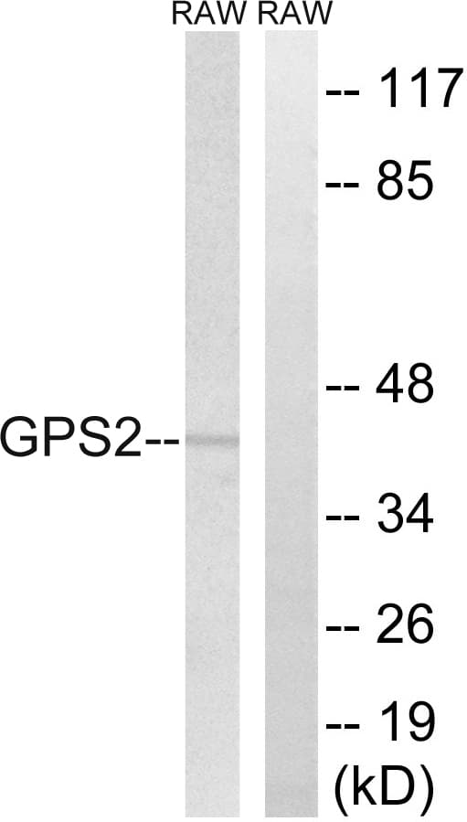 GPS2 Antibody (aa11-60)