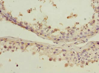 Polyclonal Rabbit anti-Human PDCD5 Antibody (IHC)