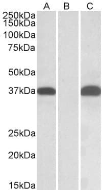 IHC-plus™ PIM2 / Pim-2 Antibody (aa23-36)