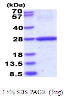 Human HLA-DOB Protein (Recombinant His)