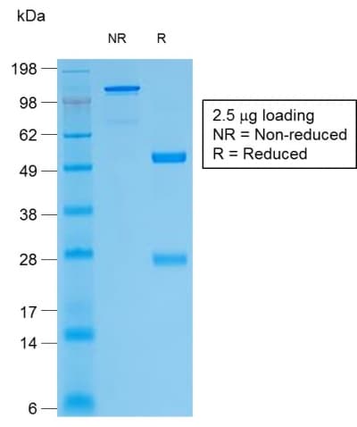 PathPlus™ TG / Thyroglobulin Antibody (clone TGB/1968R)