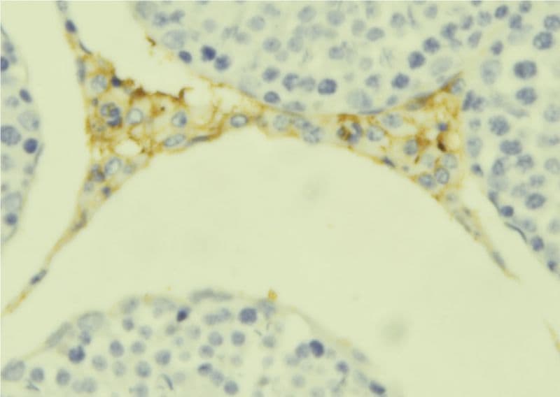 Polyclonal Rabbit anti-Human C1QL4 Antibody (IHC, WB)