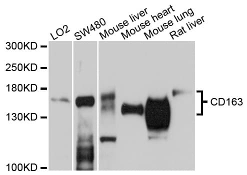 IHC-plus™ CD163 Antibody