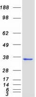 Human NEUROG3 / NGN3 / Neurogenin 3 Protein (Recombinant Myc-DDK (Flag))