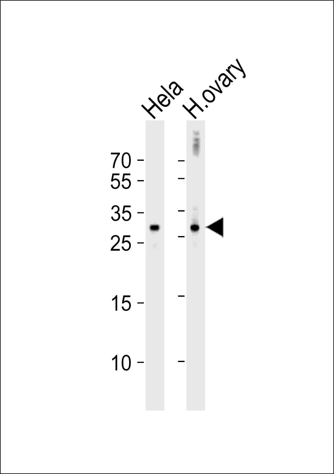 Polyclonal Rabbit anti-Human DIRAS3 / ARHI Antibody (IHC, WB)