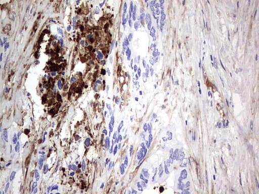 Monoclonal Mouse anti-Human FN1 / Fibronectin Antibody (clone OTI1G2, aa32-307, IHC, WB)