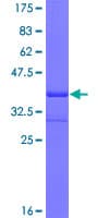 Human ADCYAP1R1 / PAC1 Receptor Protein (Recombinant GST, N-terminus)