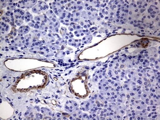 Monoclonal Mouse anti-Human MCAM / CD146 Antibody (clone OTI2G10, IHC, WB)