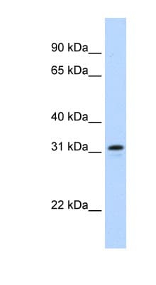NIFK / MKI67IP Antibody (aa140-189)
