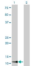 TIMM9 Antibody (clone 1D6)