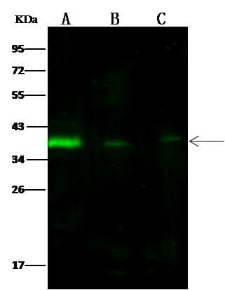 Polyclonal Rabbit anti-Human CNN1 / Calponin Antibody (Preservative Free, IHC, WB)