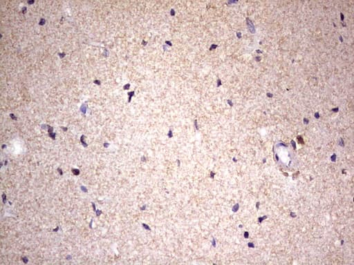 Monoclonal Mouse anti-Human GLI / GLI1 Antibody (clone OTI2E1, aa755-1106, IHC, WB)