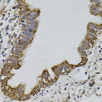 ARHGEF11 Antibody