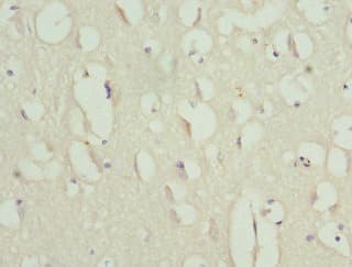 Polyclonal Rabbit anti-Human Anillin Antibody (IHC, WB)