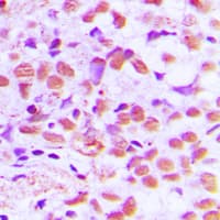Polyclonal Rabbit anti-Human SAE1 Antibody (Internal, IHC, IF, WB)