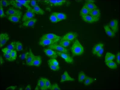 Polyclonal Rabbit anti-Human CTAGE1 / CTAGE Antibody (IF)