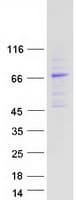 Human EEPD1 Protein (Recombinant Myc-DDK (Flag))