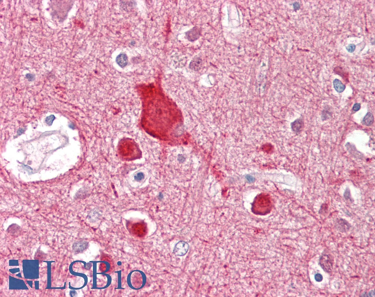 IHC-plus™ Polyclonal Goat anti-Human ABCA2 Antibody (aa2363-2376, IHC)