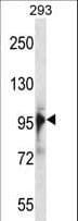 RBM10 Antibody (aa85-113)