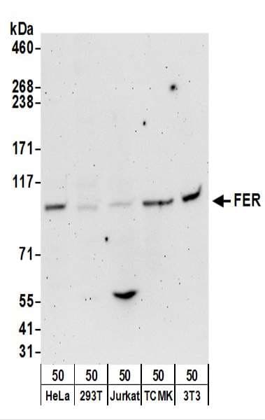 IHC-plus™ FER Antibody (aa400-450)