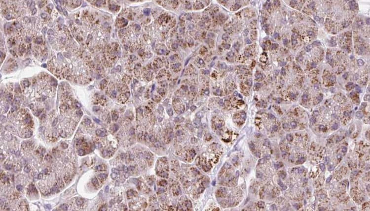 Polyclonal Rabbit anti-Human ARHGEF25 / GEFT Antibody (IHC, WB)