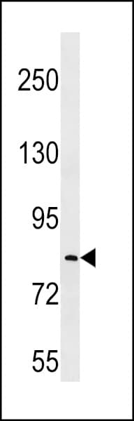 LRRC70 Antibody (aa542-570)